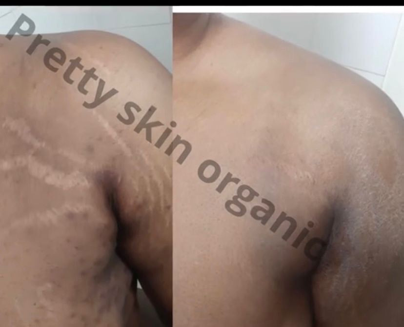 Gel noir anti vergetures