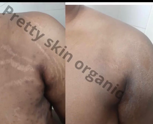 Gel noir anti vergetures