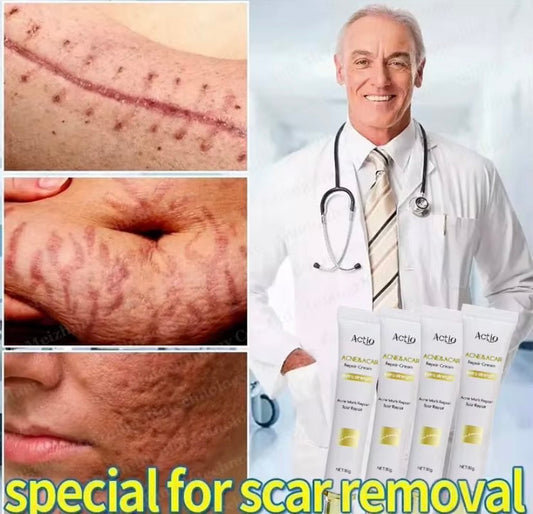 Acné et vergetures care